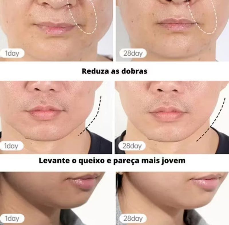 MASAJEADOR FACIAL REDUCTOR DE ARRUGAS + CREMA DEPILATORIA